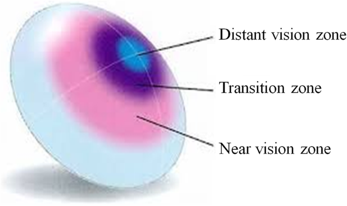  Monovision Multifocal 